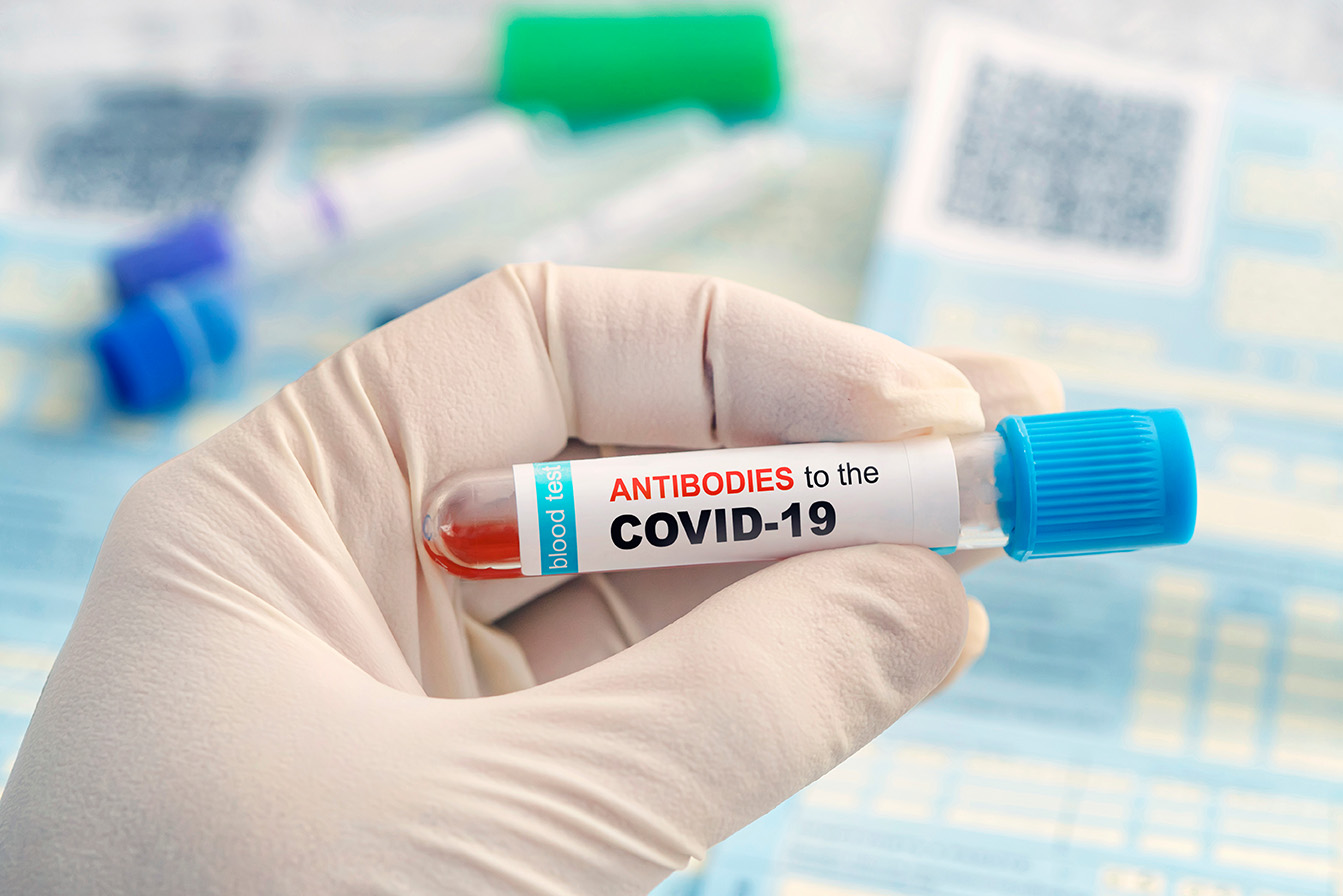 هل فحص الجسم المضاد ضروري بعد الحصول على لقاح COVID-19؟