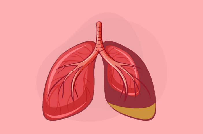 إليك كيفية تشخيص عدوى الجهاز التنفسي