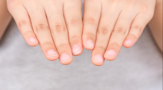 Открийте тези 9 сериозни заболявания чрез здравето на ноктите