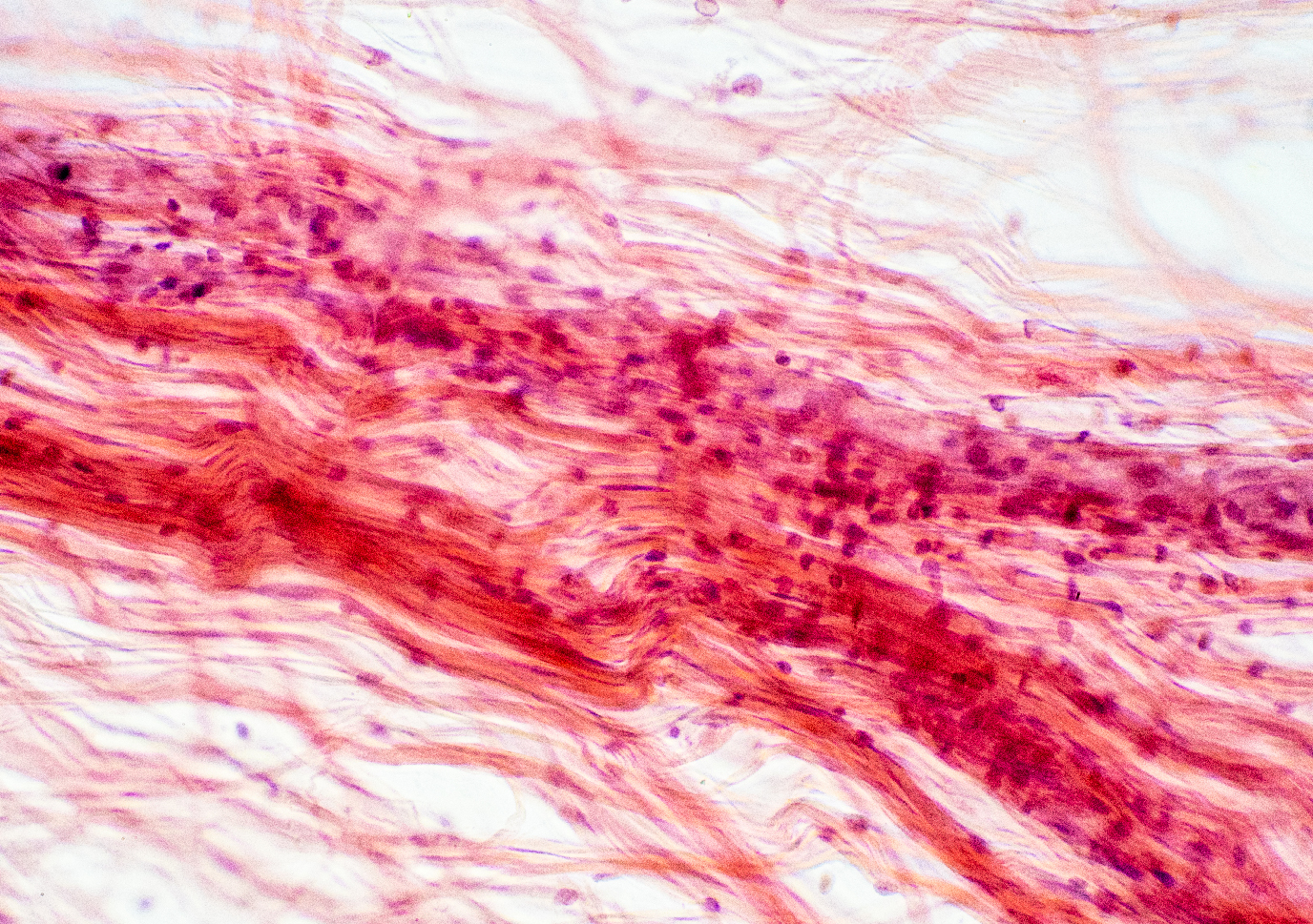 Kenali 6 jenis tisu epitelium yang berfungsi di dalam badan
