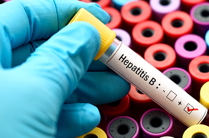 Предавани чрез телесни течности, хепатит В най -опасен?