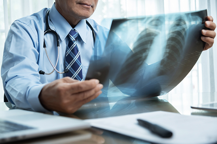 7 Bu Hastalıklar Göğüs Röntgenlerinden Anlaşılabilir