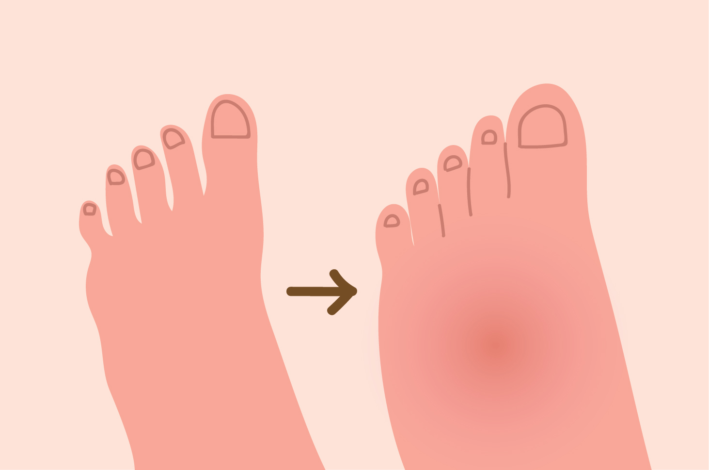 Навици, които могат да причинят подуване на краката по време на бременност