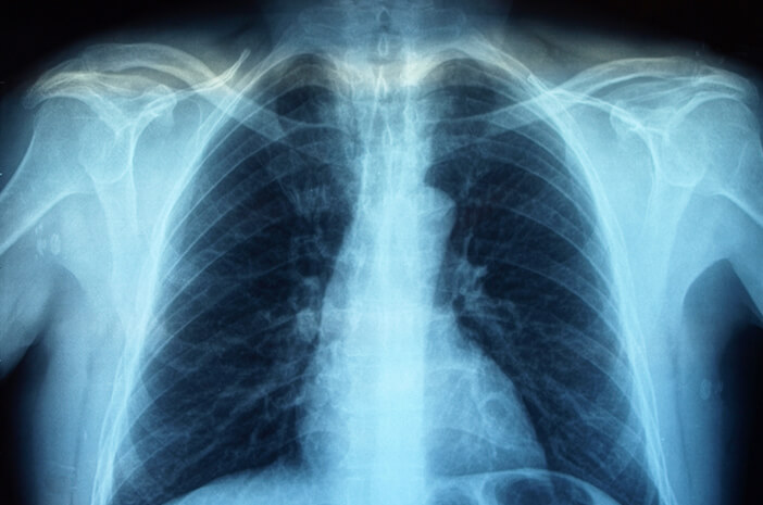 Познайте рентгеновата процедура в радиологията