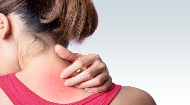 5 علامات مبكرة لسرطان الجلد يجب الانتباه إليها