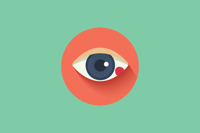 Kelopak mata bengkak adalah gejala endophthalmitis