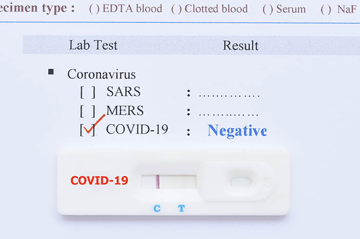 Test COVID-19 prima di salire a bordo dell'aereo, scegliere tampone antigene o PCR?