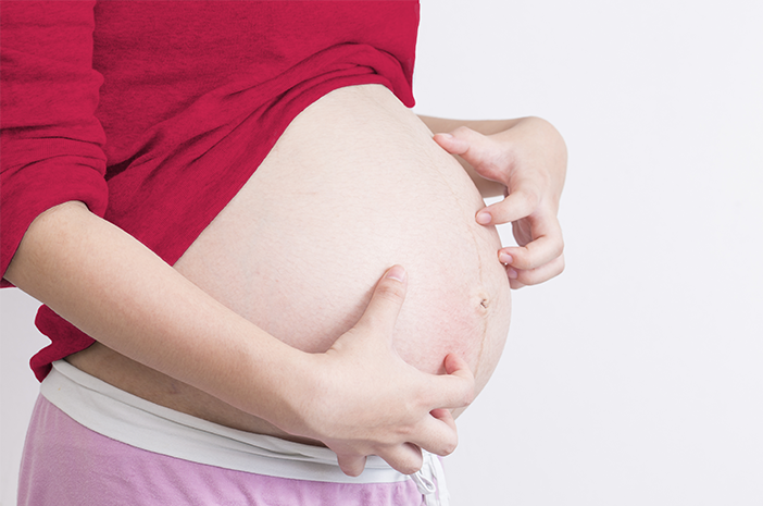 Сърбеж в стомаха поради бременност, опитайте да използвате зехтин