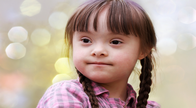Тризомия 21, една от причините за синдрома на Даун при деца