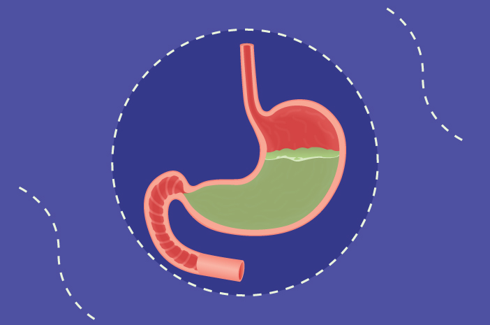 胃が膨満することが多い、胃炎に注意