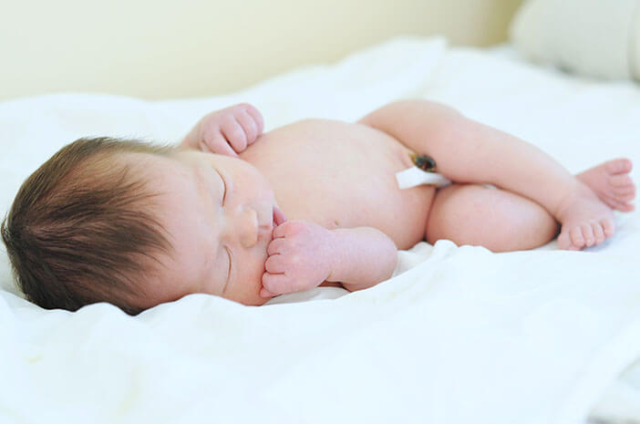 احذر من 5 مشاكل جلدية عند الأطفال حديثي الولادة