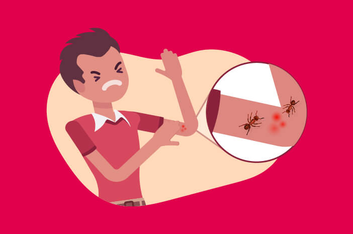 アリの咬傷を克服する効果的な方法