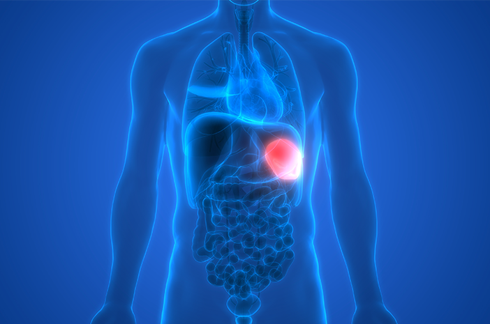 脾臓の腫れは、これらの7つの深刻な病気の兆候である可能性があります